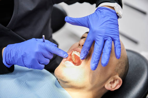 Emergency Gum Pain Relief in FL